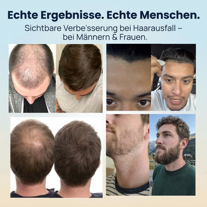 Haarkraft Wachstum Roll On Serum